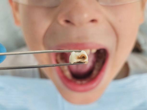 Best Orthodontic Emergency Dentist in Heber Springs, AR
